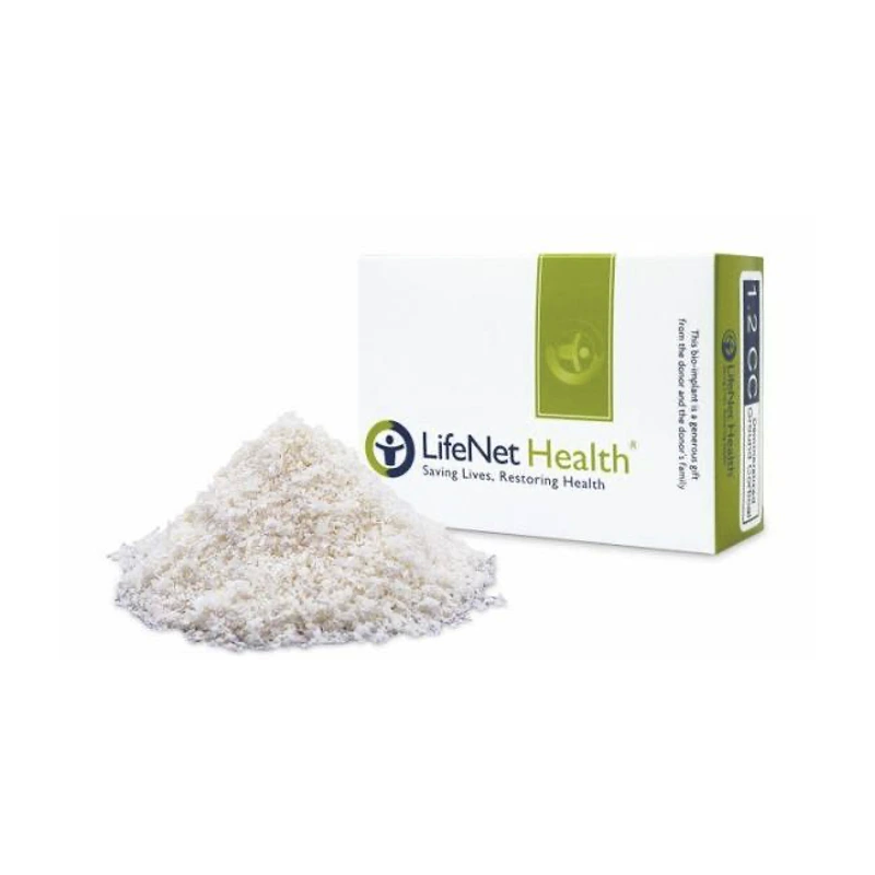 Oragraft® 1.50 cc — Bioactive Human Bone Allograft for Bone Regeneration & Ridge Preservation