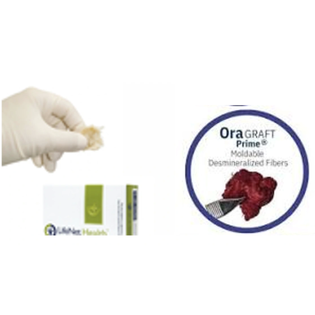 OraGraft® Prime Fibras de Hueso 2.5 cc — Aloinjerto Humano 100% Puro con Red de Fibras Entrelazadas Bioactivas